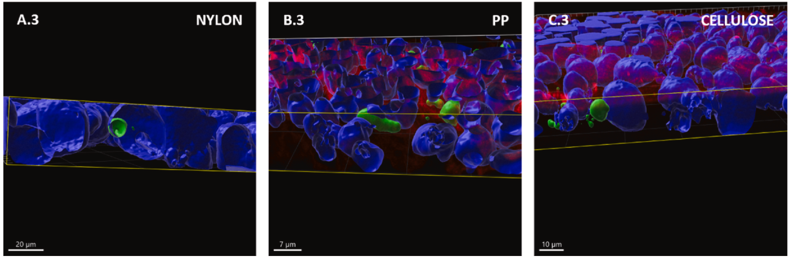 advanced imaging showing plastics from tea in human cells